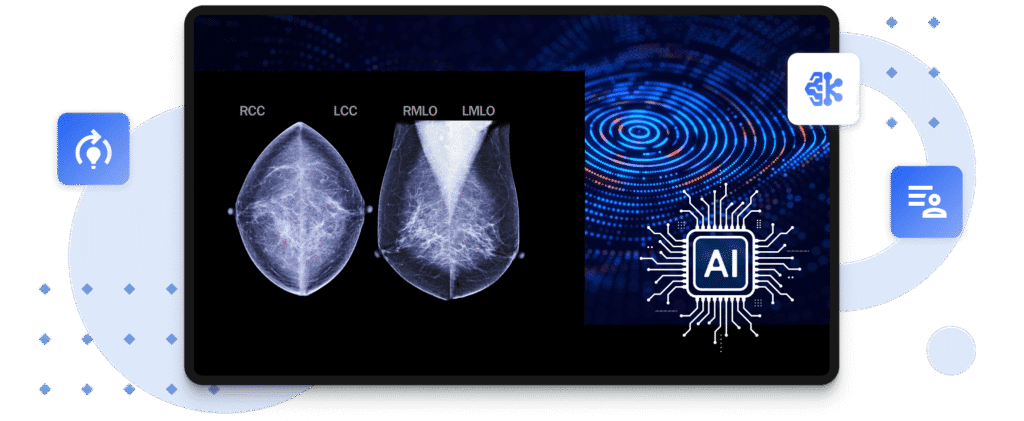 AI-Driven Mammography Analytics for Enhanced Breast Cancer Detection ...